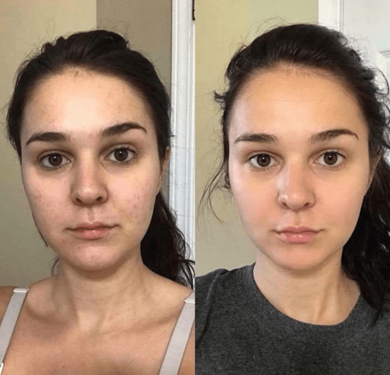 Transformation result