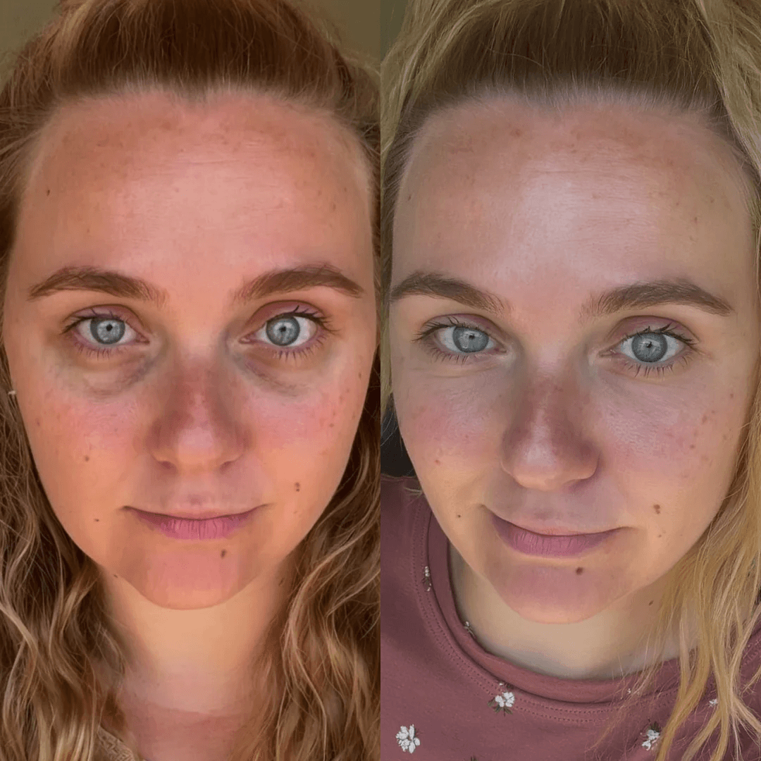 Transformation result