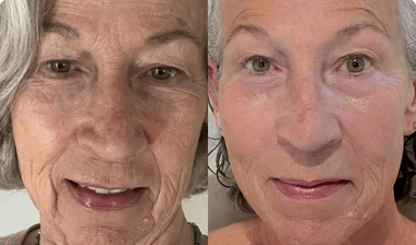 Transformation result